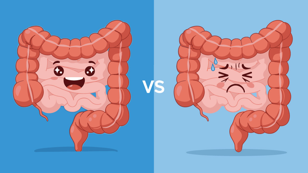 When fibre is not enough for intestinal transit