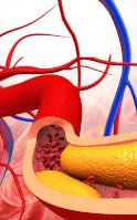 How to control cholesterol with Green tea and Red yeast rice